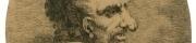Bardolph’s Rosacea